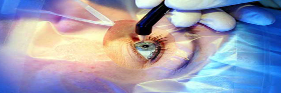 Image Ophthalmology Treatment 